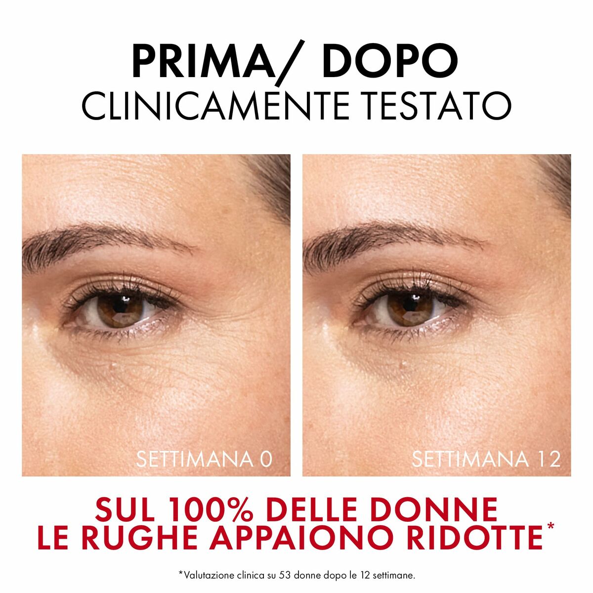 Facial Serum Vichy LIFTACTIV 30 ml