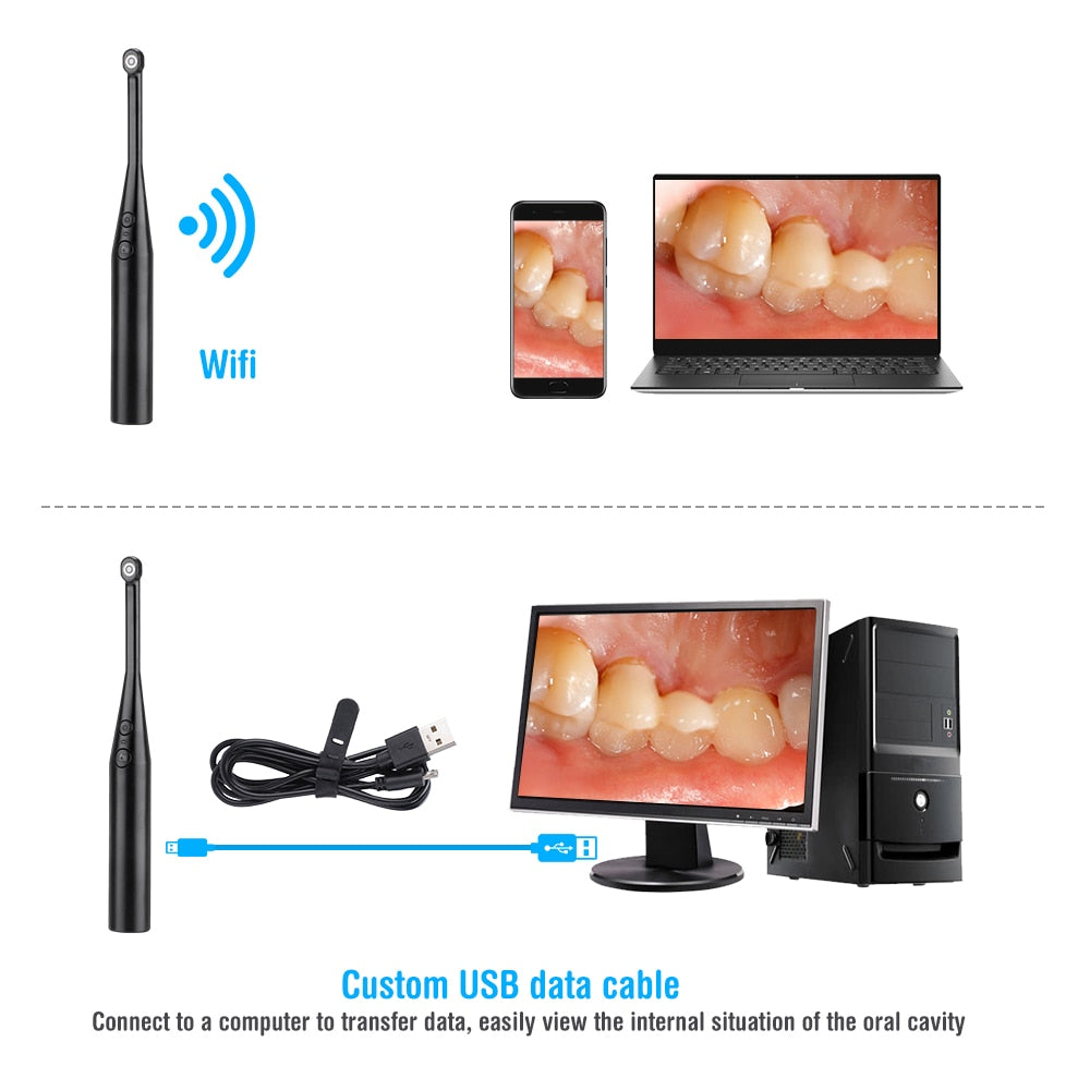 1080P HD Intraoral Dental Camera