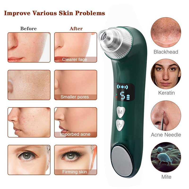 WiFi Visual Blackhead Remover & Pore Vacuum
