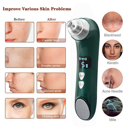 WiFi Visual Blackhead Remover & Pore Vacuum