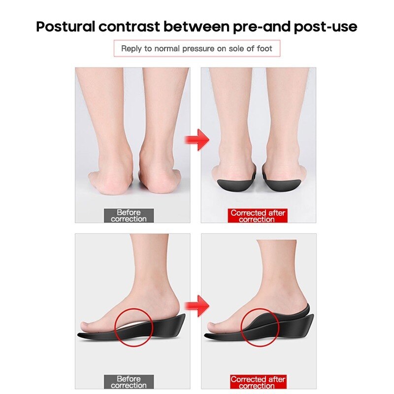 Orthotic Flatfoot Corrector Insoles