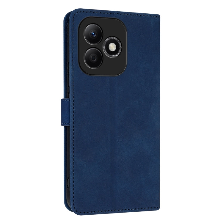 For Honor X60i AZNS Skin Feel Calf Texture Flip Leather Phone Case(Blue)