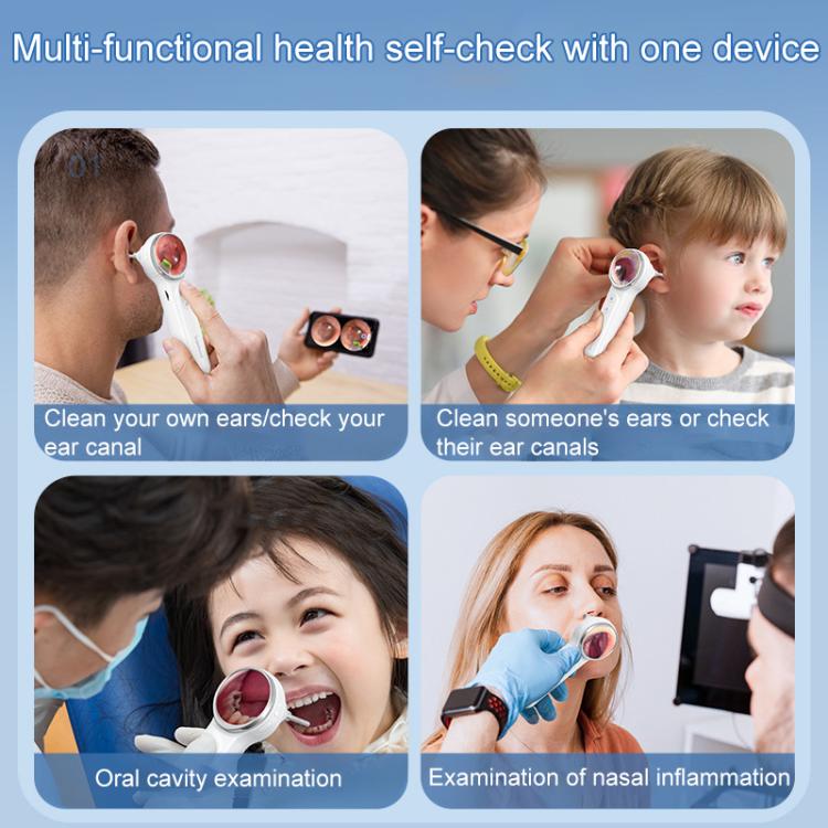 TESLONG SA200 1.85 Inch Screen WIFI Handheld Smart Visual Otoscope(White)