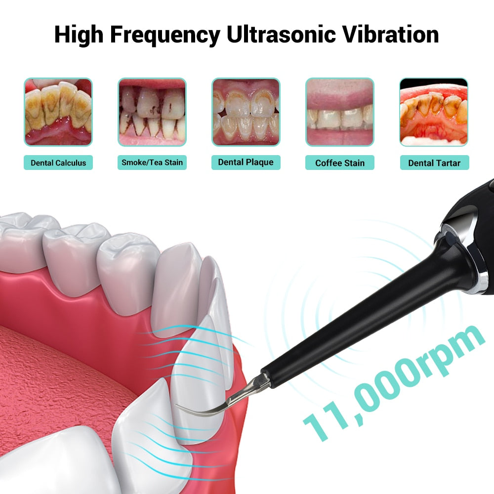 Ultrasonic Tartar & Calculus Remover