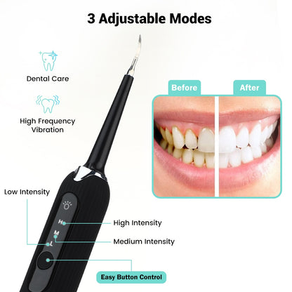 Ultrasonic Tartar & Calculus Remover
