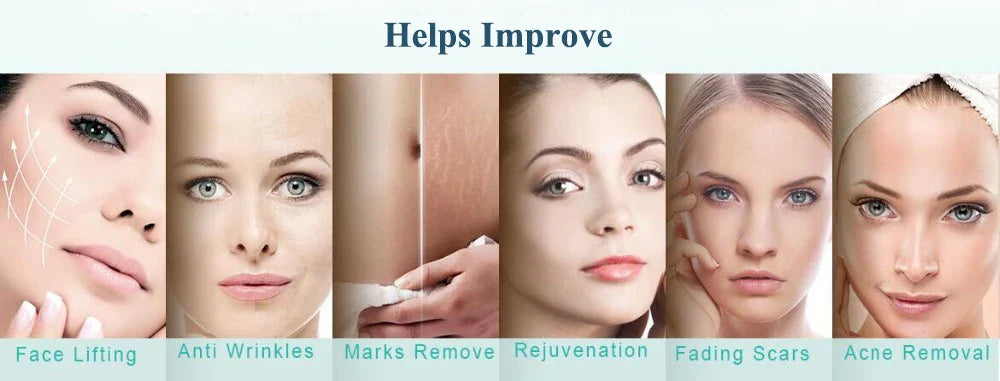 0.2/0.25/0.3mm 540 Derma Roller Micro Needle For Facial Skin Body Face Care Hair Growth Beard Acne Wrinkle Removal Microneedle