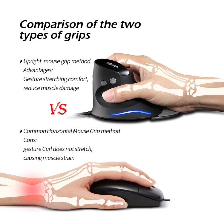 ZELOTES T30 6-keys Vertical Grip Detachable Ergonomic Wired Mouse(7-color Breathing Light)