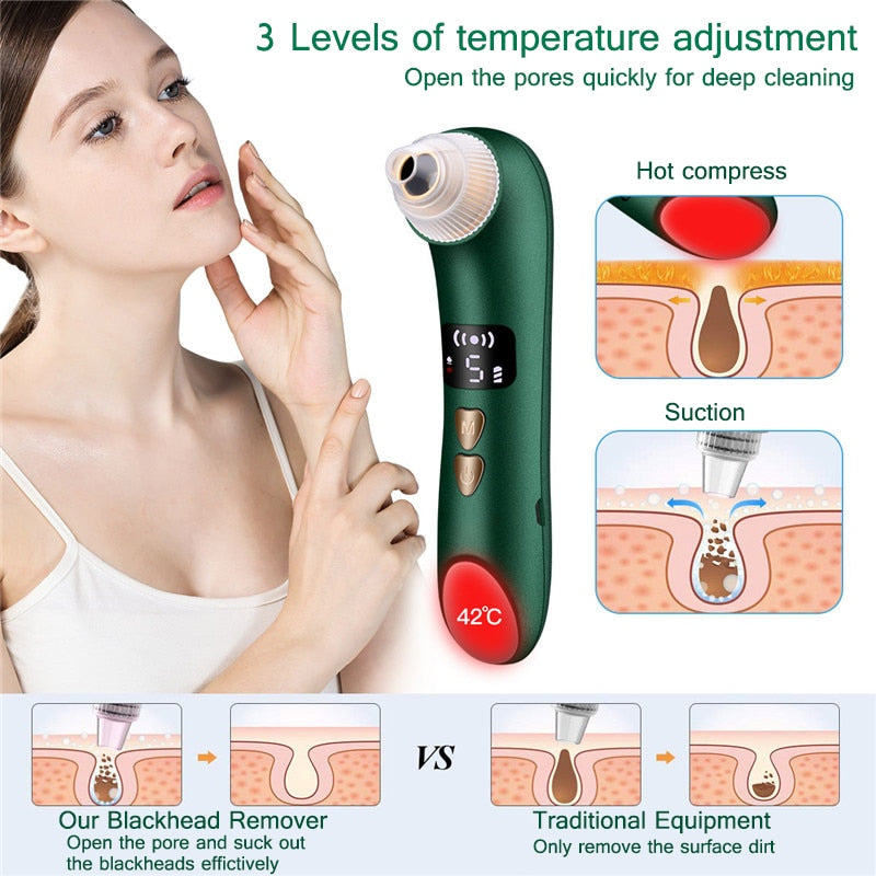 WiFi Visual Blackhead Remover & Pore Vacuum