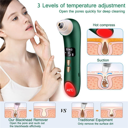 WiFi Visual Blackhead Remover & Pore Vacuum