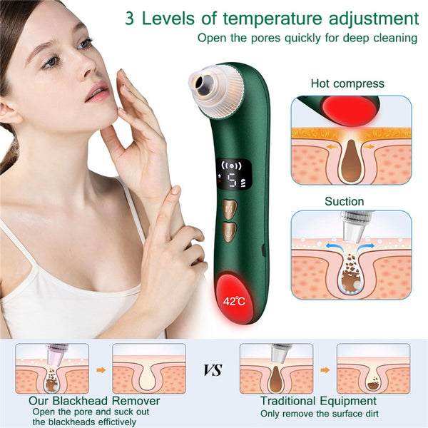 WiFi Visual Blackhead Remover & Pore Vacuum
