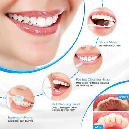 Electric Dental Calculus Remover & Teeth Whitener