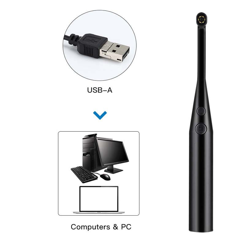 1080P HD Intraoral Dental Camera